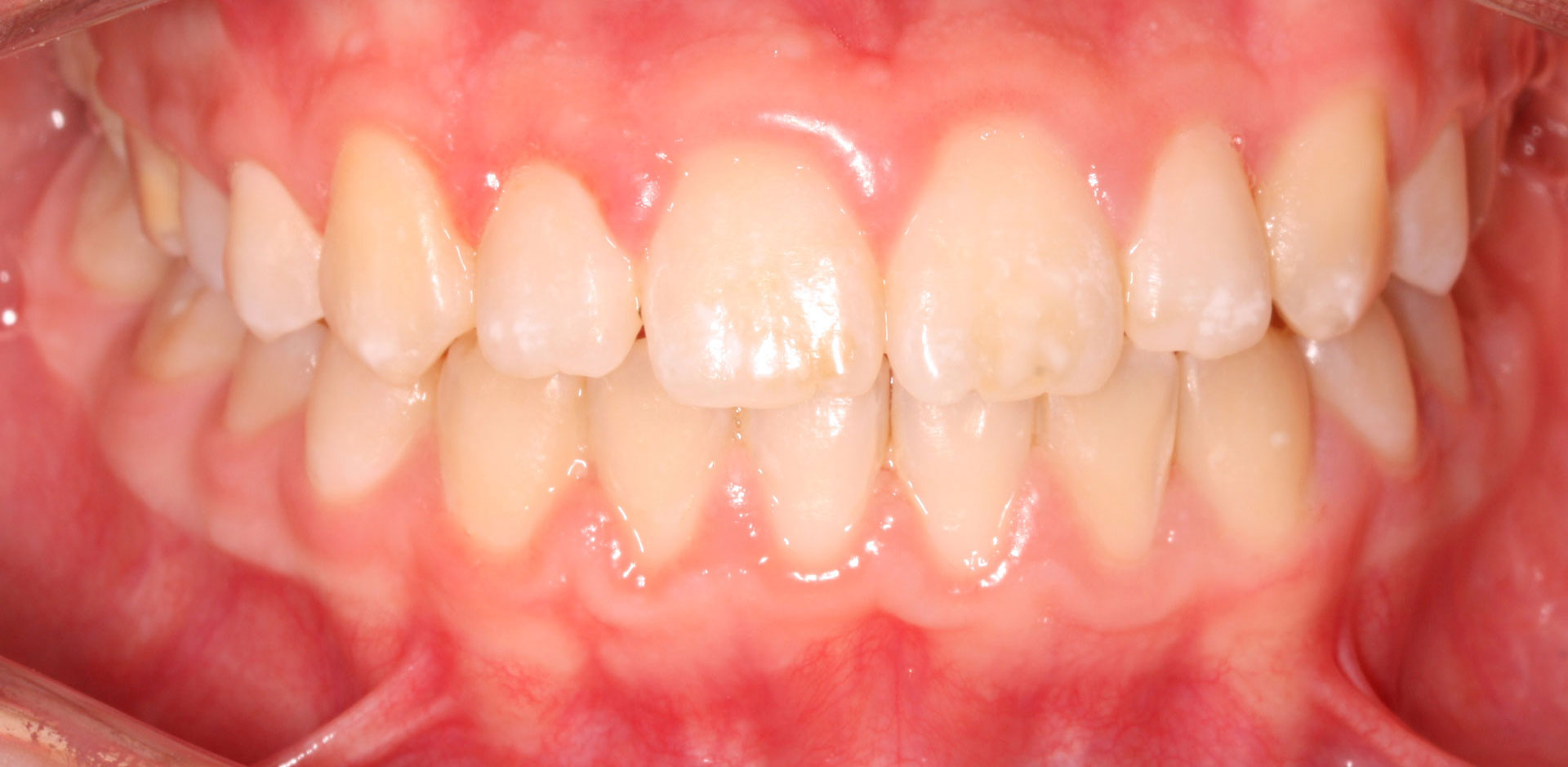 Resultado ortodoncia